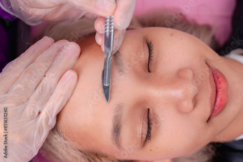 Close-up of a dermaplaning procedure exfoliating the skin and removing facial hair, performed at an aesthetic clinic. photo