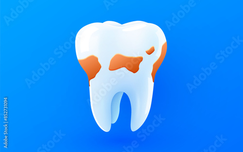 Tooth isolated on blue background. Dental plaque.