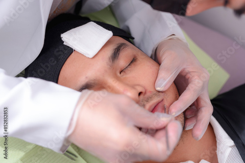 An esthetician uses a comedone extractor to precisely remove blackheads on the nose of a male patient. Facial procedure and treatment at a dermatology or aesthetic clinic.