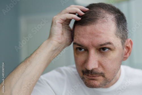 Middle aged man checking his bald spots in the mirror