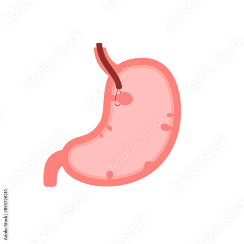 Stomach organ with polyp, gastroscopy and removal polyp. Check health of stomach. Unhealthy gastric, indigestion problems, disease concept. Risk growth cancer cells in stomach. Vector flat illustratio
