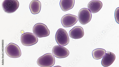 Starch granules of peacock ginger or Indian crocus (Kaempferia rotunda) tuber. Stained by lugol iodine. Objective 40x + camera zoom. Selective focus image photo