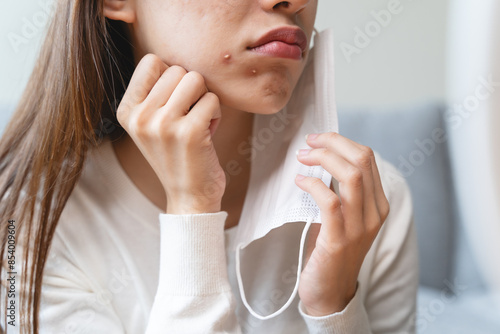 Asian young woman worry about acne on her face after wear face mask.