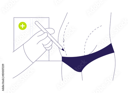 Abdominoplasty abstract concept vector illustration.
