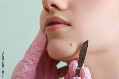 Surgeon with scalpel and mole on woman's chin against green background, closeup photo