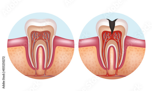 The structure of a human tooth. Anatomy of the tooth. Vector illustration. photo