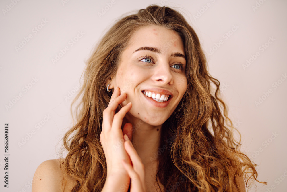 Woman no make up with red spots on her face. Health problem, skin diseases. Medicine and cosmetology concept. Woman no make up with red spots on her face. Health problem, skin diseases. Medicine and cosmetology concept.