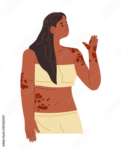 Woman with Rash on Arm vector