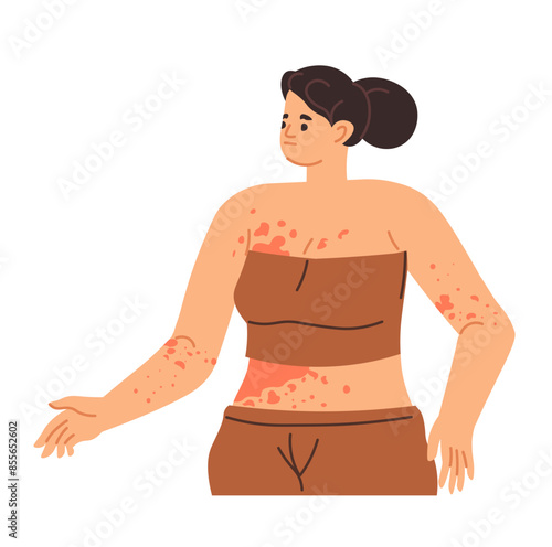 Woman with Rash on Arm vector