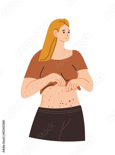 Woman with Rash on Stomach