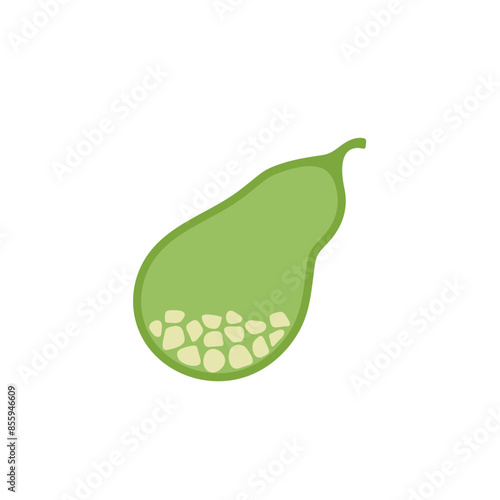 Gallbladder sick with stones. Cholecystitis, gallstone disease. Vector illustration