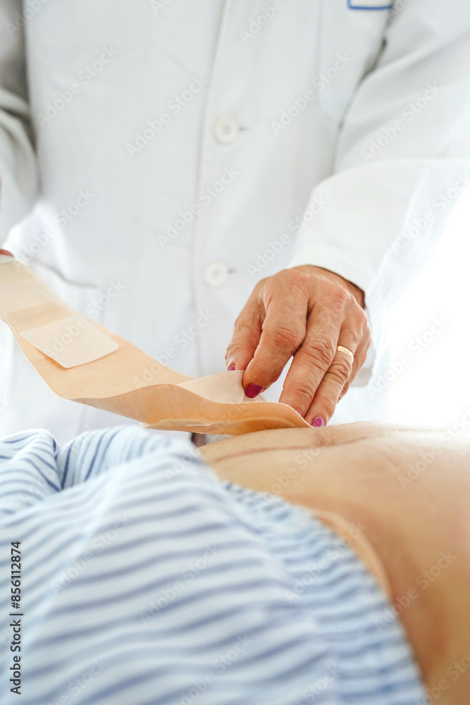 Woman doctor showing a stoma bag in a hospital. Oncology treatment Woman doctor showing a stoma bag in a hospital. Oncology treatment