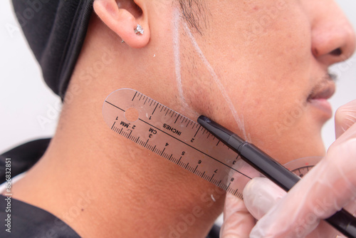 Fotografie An esthetician marking lines on a man's jaw area as a guide for jawline filler procedure