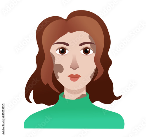 Woman with vitiligo vector drawing