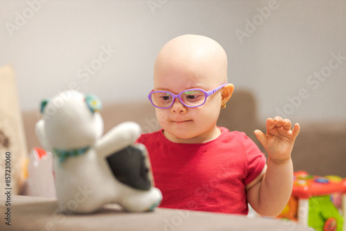 Girl with cancer and hair loss due to chemotherapy