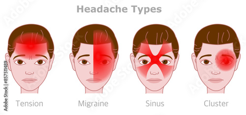 Head, face pains. Headache types. Cluster, sinus, tension, migraine. Different treatment. Sick female cartoon face. Woman face gradient red location, area. Vector illustration