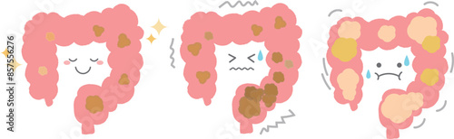 健康な腸と便秘・ガスがたまった腸　手書き風キャラクター