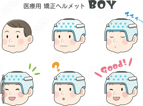 矯正ヘルメット、赤ちゃん、男の子、ベビー、イラスト、illustration