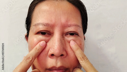 Portrait the wrinkle and Flabby skin, swelling and ptosis beside the eyelid, dark spots and blemish, freckles and scar on the face of middle aged woman, health care and beauty concept.
