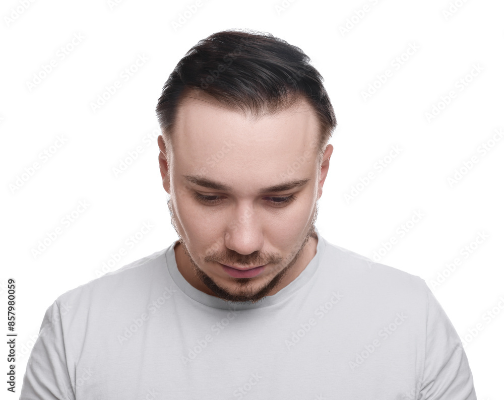 Obraz premium Baldness concept. Sad man with receding hairline on white background