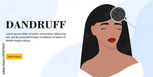 Women's dandruff problem on the head banner. Hair scalp problem. Fungal skin disease