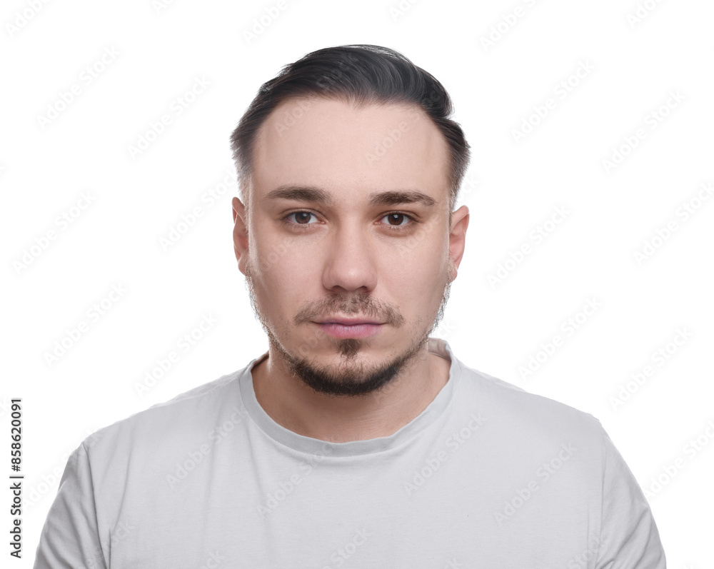 Baldness concept. Sad man with receding hairline on white background Baldness concept. Sad man with receding hairline on white background