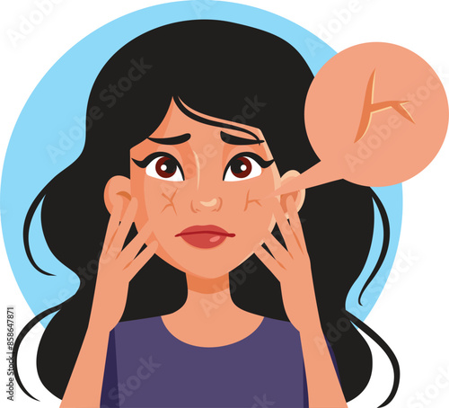 Woman with Dry Face Skin Problem Vector Illustration. Sad girl battling dryness of the skin at an early age 
