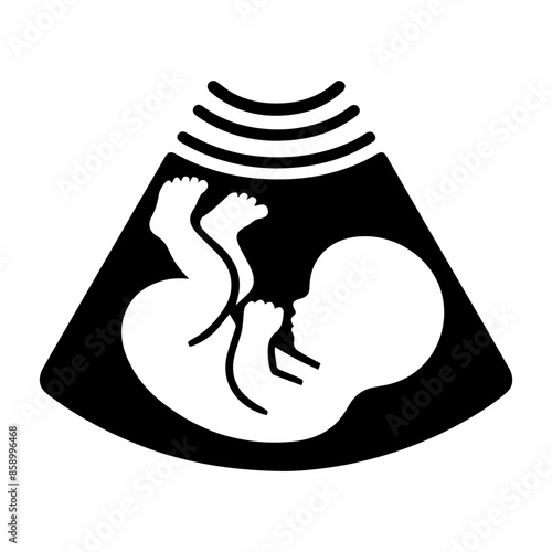 Baby Sonogram Diagram Clipart
