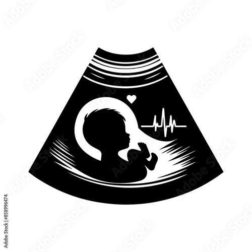 Baby Sonogram Diagram Clipart