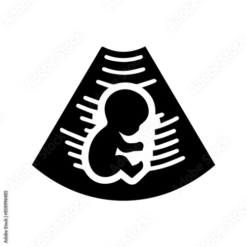 Baby Sonogram Diagram Clipart