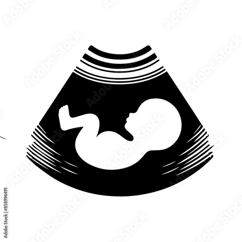 Baby Sonogram Diagram Clipart