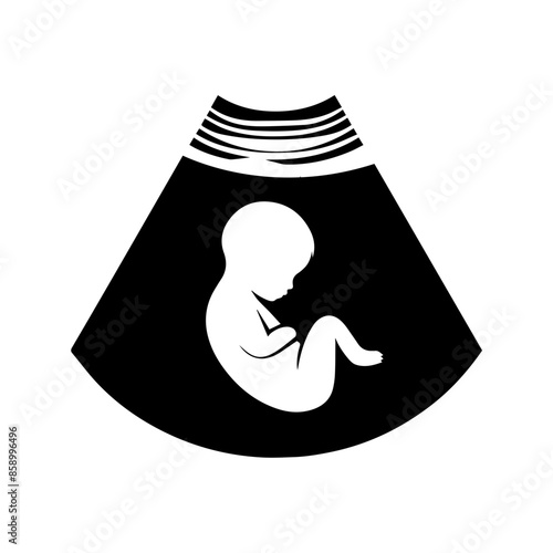 Baby Sonogram Diagram Clipart
