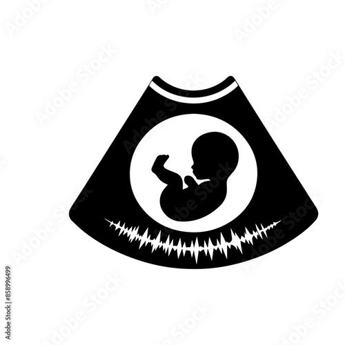 Baby Sonogram Diagram Clipart