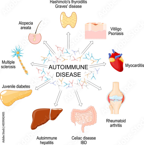 Autoimmune disease