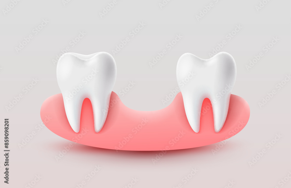 Dental implantation, tooth restoration, symbol on a white background. Vector illustration Dental implantation, tooth restoration, symbol on a white background. Vector illustration