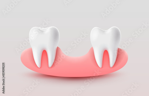 Dental implantation, tooth restoration, symbol on a white background. Vector illustration