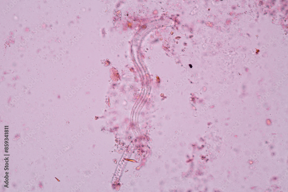 View in microscopic Strongyloides stercoralis or threadworm in human