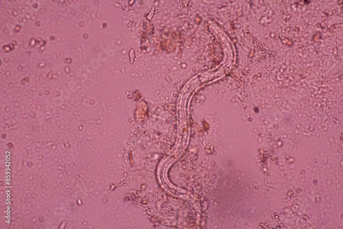 View in microscopic Strongyloides stercoralis or threadworm in human stool.Parasite infection.Medical background analyze by microscope, original magnification 400x photo