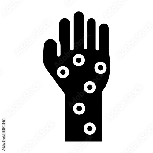 Hand Rash Vector Glyph Icon