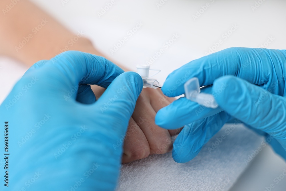 Nurse inputting catheter for IV drip in patient hand, closeup Nurse inputting catheter for IV drip in patient hand, closeup
