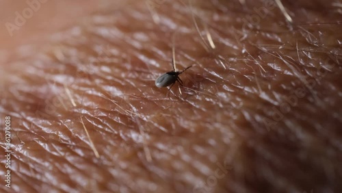 A tick on the skin that transmits dangerous diseases such as tick-borne encephalitis or Lyme disease.