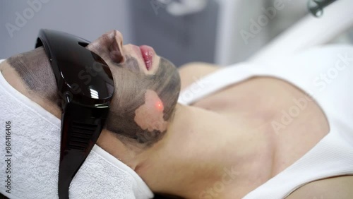 A beauty spa offers a laser facial treatment. Light. A woman undergoes a rejuvenating peel with a carbon mask, promoting skincare and reducing pigmented lesions. Female face cosmetic