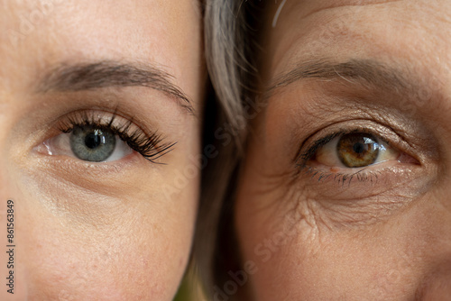 A close-up comparison of the eyes of a young woman and an older woman, highlighting the visible differences in skin texture and wrinkles