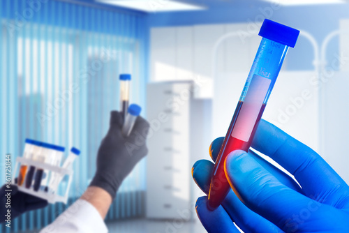 Human blood in test tubes. ...