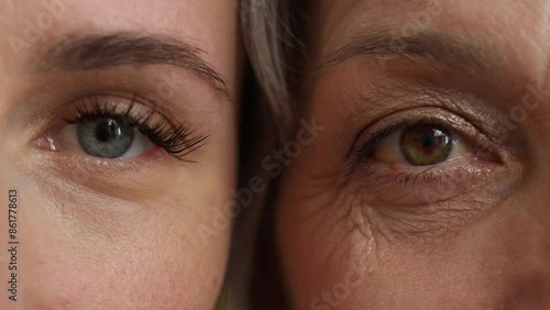 Close-up of a woman's eyes, emphasizing the wrinkles that appear with age. The main focus is on the delicate skin around the eyes, which allows you to capture the natural aging process