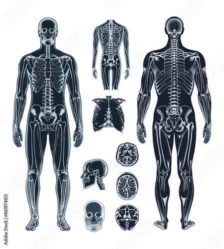 Human body x-ray cartoon vector set. Head torso back brain skeleton bones skull medical examination pictures, illustrations isolated on white background