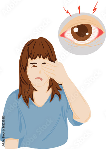Drawing of a woman with sore eyes, eye infection, red eyes, irritant eyes, fungal  infection. Vector illustration