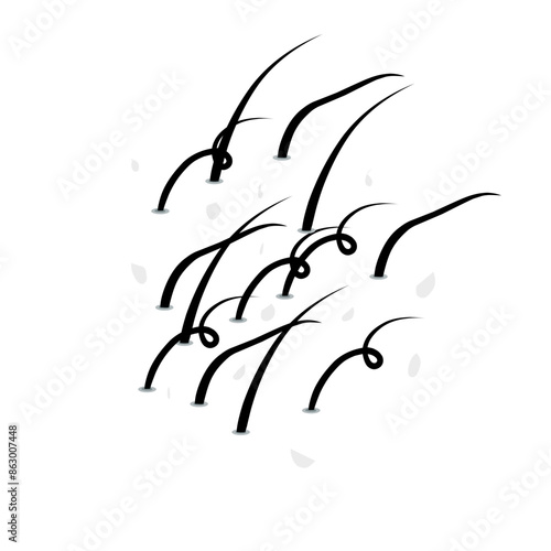 hair dandruff