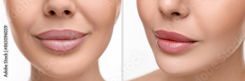Permanent makeup. Collage with photos of woman before and after lip blushing on white background, closeup