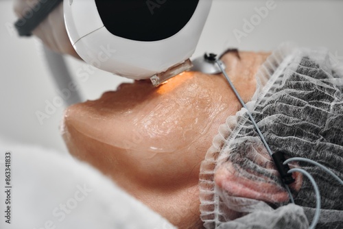 A woman receives IPL therapy in a beauty salon.